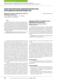 Оценка морфологических изменений венозной стенки после радиочастотной облитерации IN VIVO