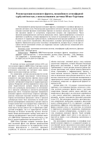 Реконструкция волнового фронта, искажённого атмосферной турбулентностью, с использованием датчика Шэка-Гартмана