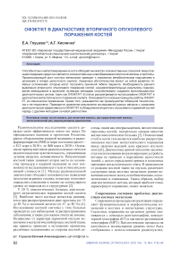 ОФЭКТ/КТ в диагностике вторичного опухолевого поражения костей