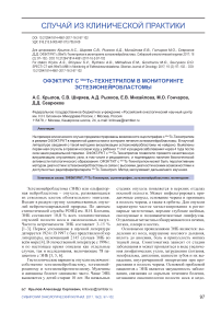 ОФЭКТ/РКТ с 99mTc-технетрилом в мониторинге эстезионейробластомы