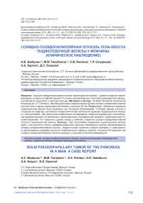 Солидно-псевдопапиллярная опухоль тела-хвоста поджелудочной железы у мужчины (клиническое наблюдение)