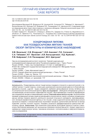 Хондроидная липома как псевдосаркома мягких тканей: обзор литературы и клиническое наблюдение