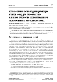 Использование остеомодифицирующих агентов (ома) для профилактики и лечения патологии костной ткани при злокачественных новообразованиях