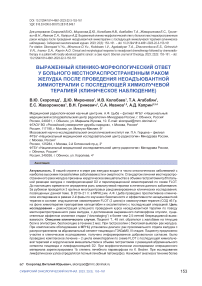 Выраженный клинико-морфологический ответ у больного местнораспространенным раком желудка после проведения неоадъювантной химиотерапии с последующей химиолучевой терапией (клиническое наблюдение)