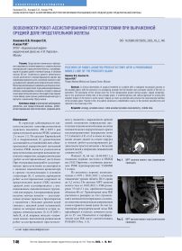 Особенности робот-ассистированной простатэктомии при выраженной средней доле предстательной железы
