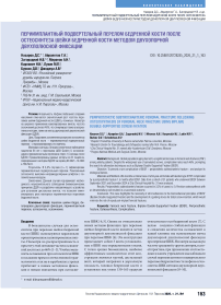 Периимплантный подвертельный перелом бедренной кости после остеосинтеза шейки бедренной кости методом двухопорной двухполюсной фиксации