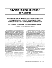 Использование материала на основе пористого никелида титана в хирургическом лечении распространенного рака щитовидной железы