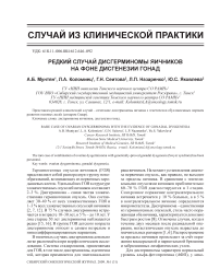 Редкий случай дисгерминомы яичников на фоне дисгенезии гонад