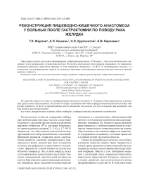 Реконструкция пищеводно-кишечного анастомоза у больных после гастрэктомии по поводу рака желудка