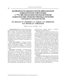 Возможности однофотонной эмиссионной компьютерной томографии c 99mTc-метокси-изобутил-изонетрилом в диагностике злокачественных опухолей гортани и гортаноглотки