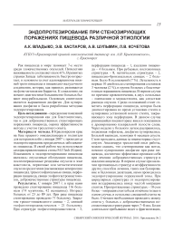 Эндопротезирование при стенозирующих поражениях пищевода различной этиологии