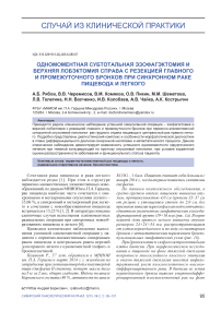 Одномоментная субтотальная эзофагэктомия и верхняя лобэктомия справа с резекцией главного и промежуточного бронхов при синхронном раке пищевода и легкого