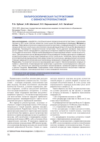 Лапароскопическая гастрэктомия с еюногастропластикой