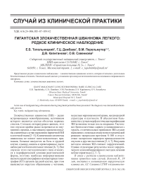 Гигантская злокачественная шваннома легкого: редкое клиническое наблюдение