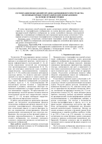 Сегментация изображений органов забрюшинного пространства по компьютерным томографическим изображениям на основе функции уровня