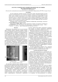 Система технического зрения для контроля состояния железнодорожного пути