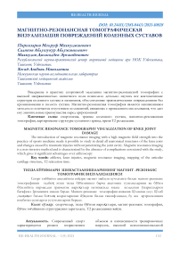 Магнитно-резонансная томографическая визуализация повреждений коленных суставов