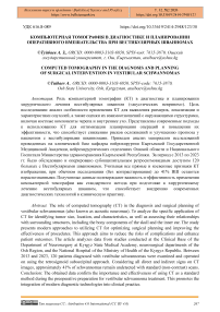 Компьютерная томография в диагностике и планировании оперативного вмешательства при вестибулярных шванномах