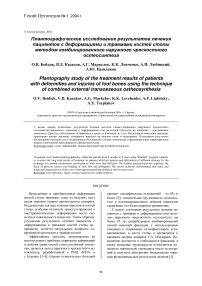 Плантографическое исследование результатов лечения пациентов с деформациями и травмами костей стопы методом комбинированного наружного чрескостного остеосинтеза