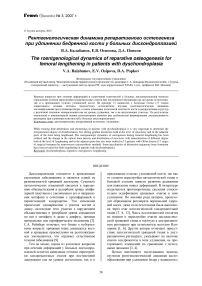 Рентгенологическая динамика репаративного остеогенеза при удлинении бедренной кости у больных дисхондроплазией