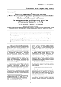 Реконструкция тазобедренного сустава у детей дошкольного возраста с врожденным вывихом бедра