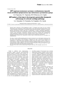 МРТ-картина коленного сустава в отдаленном периоде после лечебной артроскопии при патологии суставного хряща