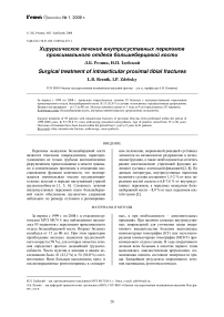 Хирургическое лечение внутрисуставных переломов проксимального отдела большеберцовой кости