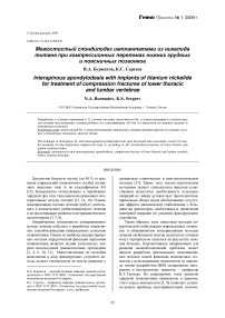 Межостистый спондилодез имплантатами из никелида титана при компрессионных переломах нижних грудных и поясничных позвонков