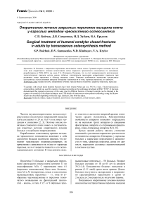 Оперативное лечение закрытых переломов мыщелка плеча у взрослых методом чрескостного остеосинтеза