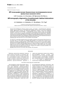 МР-томографическая диагностика посттравматических привычных вывихов плеча