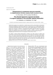 Направленный лигаменто-капсуло-тенодез в оперативном лечении привычного вывиха плеча