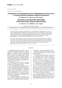 Устранение посттравматических деформации костей кисти с использованием аппарата наружной фиксации