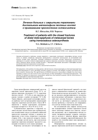 Лечение больных с закрытыми переломами дистального метаэпифиза пястных костей c применением чрескостного остеосинтеза