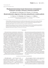 Морфорентгенометрическая диагностика остеоартроза коленного сустава у больных пожилого возраста
