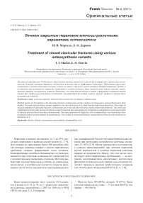 Лечение закрытых переломов ключицы различными вариантами остеосинтеза