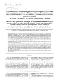 Структура и количественная оценка плотности кости и содержания минеральных веществ у больных витамин D-резистентным рахитом и у больных с последствиями витамин D-дефицитного рахита до лечения