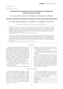 Применение дистракционного аппарата при переломах пястных костей кисти