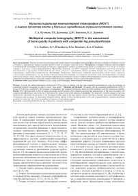 Мультиспиральная компьютерная томография (МСКТ)в оценке качества кости у больных врожденным ложным суставом голени
