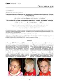 Современное представление об акроцефалосиндактилии у детей (по данным литературы)