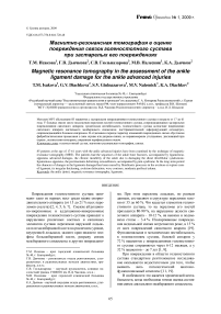 Магнитно-резонансная томография в оценке повреждения связок голеностопного сустава при застарелых его повреждениях