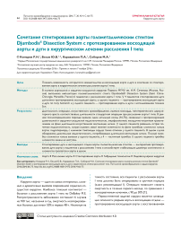 Сочетание стентирования аорты голометаллическим стентом Djumbodis® Dissection System с протезированием восходящей аорты и дуги в хирургическом лечении расслоения I типа