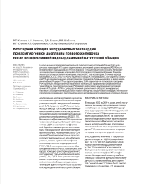 Катетерная аблация желудочковых тахикардий при аритмогенной дисплазии правого желудочка после неэффективной эндокардиальной катетерной аблации