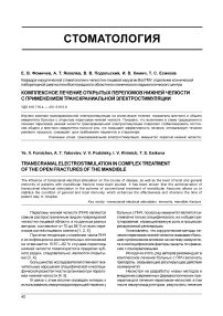 Комплексное лечение открытых переломов нижней челюсти с применением транскраниальной электростимуляции