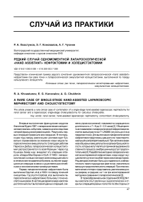 Редкий случай одномоментной лапароскопической «hand assistant» нефрэктомии и холецистэктомии