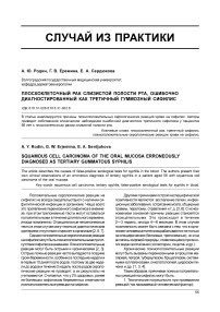 Плоскоклеточный рак слизистой полости рта, ошибочно диагностированный как третичный гуммозный сифилис