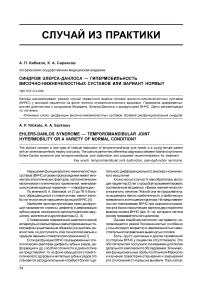 Синдром Элерса-Данлоса - гипермобильность височно-нижнечелюстных суставов или вариант нормы?