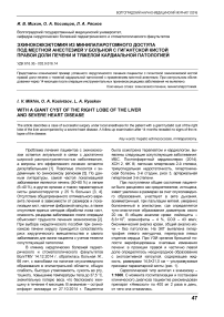 Эхинококкэктомия из минилапаротомного доступа под местной анестезией у больной с гигантской кистой правой доли печени и тяжелой кардиальной патологией