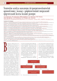 Технические аспекты выполнения экстраперитонеоскопической аденомэктомии у больных с доброкачественной гиперплазией предстательной железы больших размеров