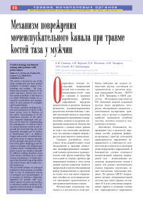 Механизм повреждения мочеиспускательного канала при травме костей таза у мужчин