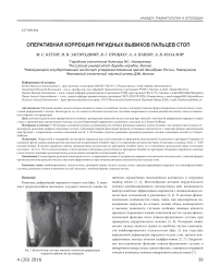 Оперативная коррекция ригидных вывихов пальцев стоп